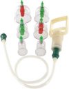 Cupping Therapy 6-piece Vacuum Cup Set